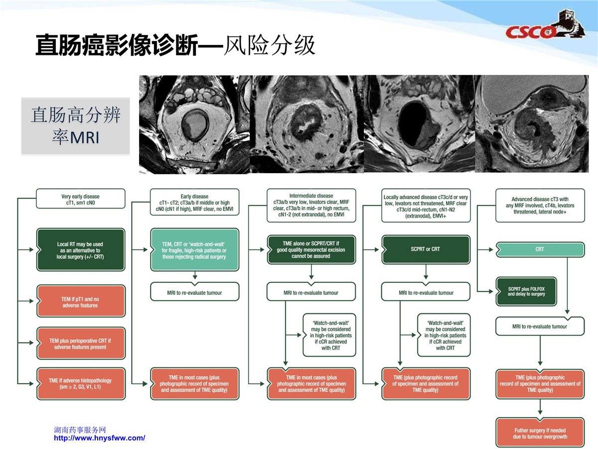 一文读懂胃癌的TNM分期 - 知乎